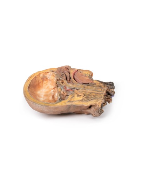 Sagittal section of head and neck with intratemporal fossa and carotid sheath - Erler Zimmer 3D anatomy Series MP1111
