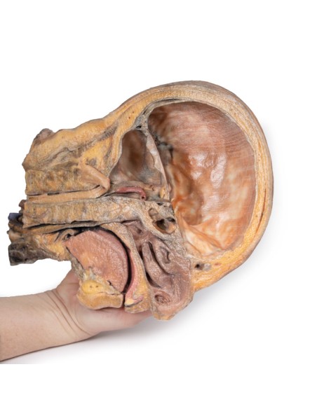 Sagittal section of head and neck with intratemporal fossa and carotid sheath - Erler Zimmer 3D anatomy Series MP1111