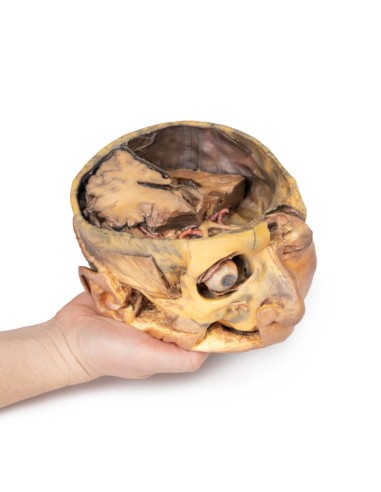 Cross section of the head - Erler Zimmer 3D...