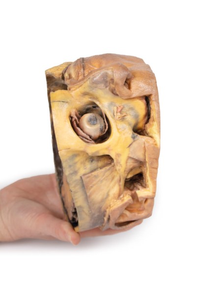 Querschnitt durch den Kopf - Erler Zimmer 3D-Anatomie Serie MP1110