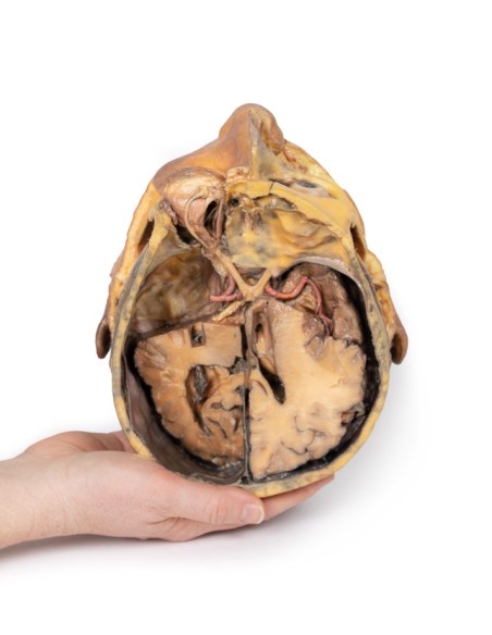 Querschnitt durch den Kopf - Erler Zimmer 3D-Anatomie Serie MP1110