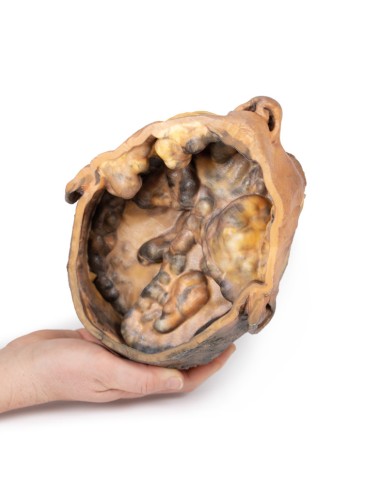 Cross section of the head - Erler Zimmer 3D...