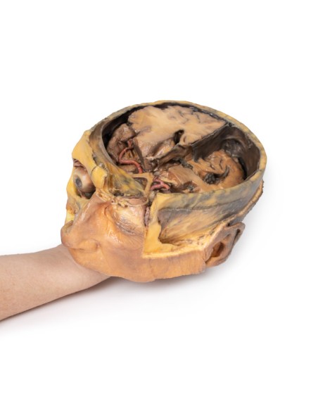 Cross section of the head - Erler Zimmer 3D anatomy Series MP1110