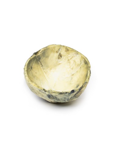 Syphilis tertiaire - Erler Zimmer 3D anatomy...