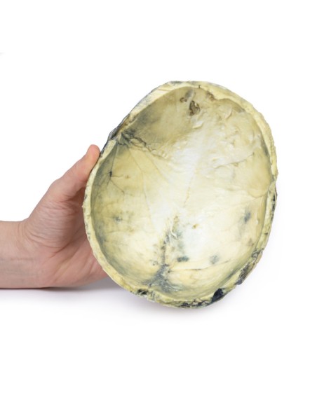 Syphilis tertiaire - Erler Zimmer 3D anatomy Series MP2113