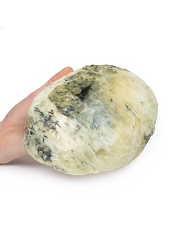 Tertiäre Syphilis - Erler Zimmer 3D-Anatomie...