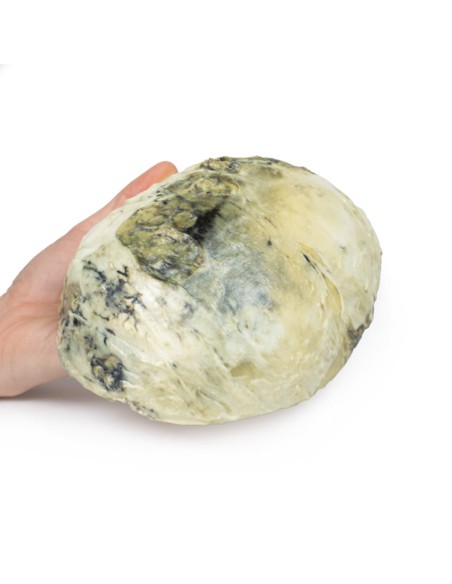 Tertiäre Syphilis - Erler Zimmer 3D-Anatomie Serie MP2113