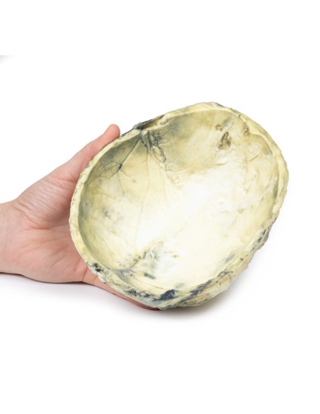 Tertiary syphilis - Erler Zimmer 3D anatomy Series MP2113