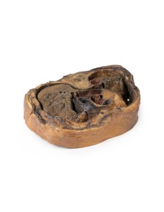 Sección torácica en vértebra T6 - Erler Zimmer 3D anatomy...