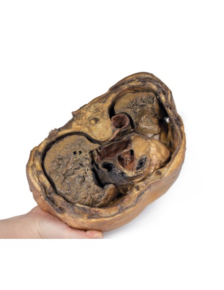 Sezione del torace sulla vertebra T6 - Erler Zimmer 3D anatomy Series MP1120