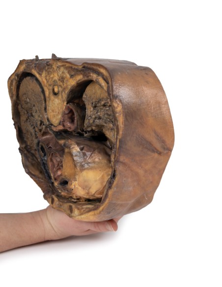 Sezione del torace sulla vertebra T6 - Erler Zimmer 3D anatomy Series MP1120