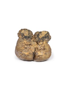 Renal cell carcinoma - Erler Zimmer 3D anatomy Series MP2097