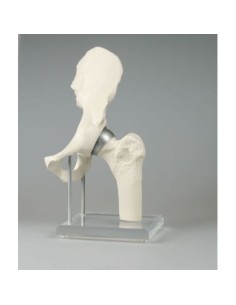 Erler Zimmer, anatomical model of hip joint, with...