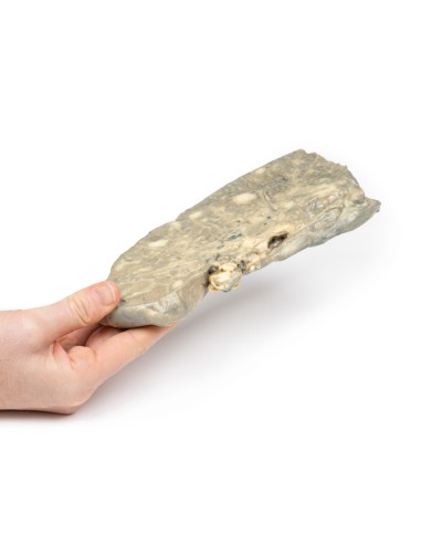 Carcinoma metastatico nel polmone - Erler...