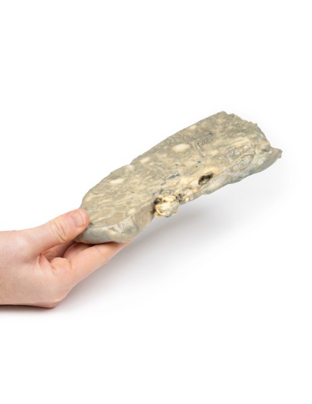 Carcinome métastatique du poumon - Erler Zimmer 3D anatomy Series MP2056