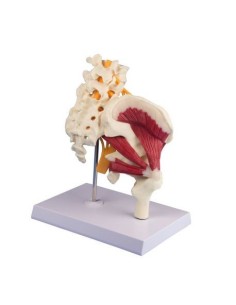 Erler Zimmer, modèle anatomique de l'articulation de la...