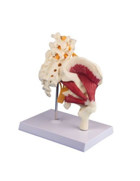 Erler Zimmer, anatomisches Modell des Hüftgelenks mit Muskeln und Ischiasnerv 4049