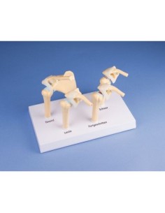 Erler Zimmer, modèle anatomique des 4 stades de...