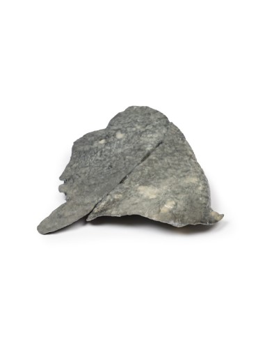 Lunge: multiple Ablagerungen von...