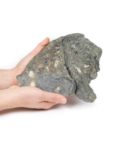 Poumon : dépôts multiples de carcinome...