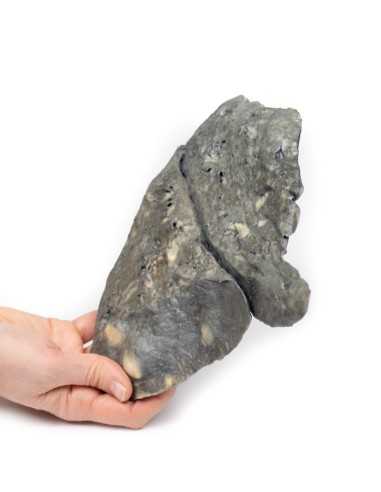 Lunge: multiple Ablagerungen von...