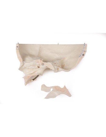 Luxus-Kinderschädel für Fortgeschrittene, in 14 Teilen Erler Zimmer 4810