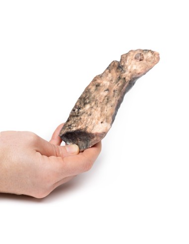 Pulmón: fibrosis quística - Erler Zimmer 3D...