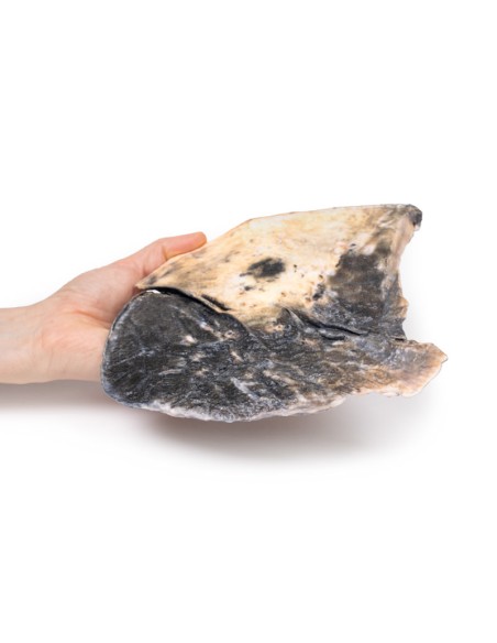 Polmonite lobare - Erler Zimmer 3D anatomy Series MP2057