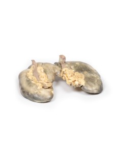 Rene a ferro di cavallo - Erler Zimmer 3D anatomy Series... 2