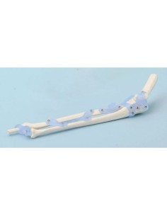 Erler Zimmer, modello anatomico funzionale di...