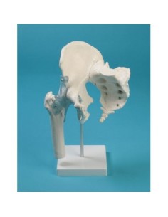 Erler Zimmer, functional model of hip joint, with...