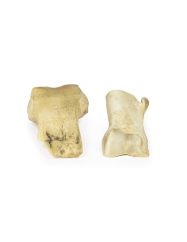 Osteocondroma - Erler Zimmer 3D anatomy Series...