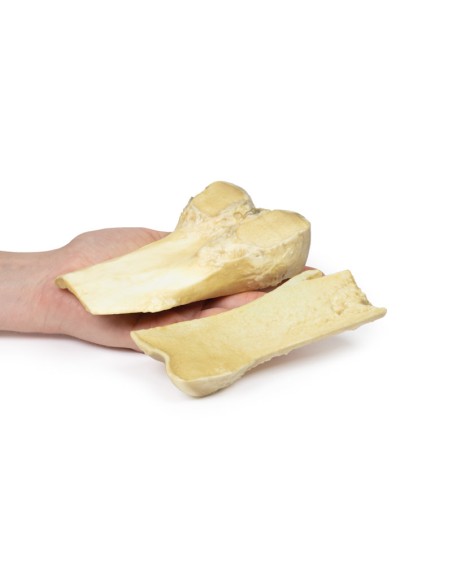 Osteocondroma - Erler Zimmer 3D anatomy Series MP2118