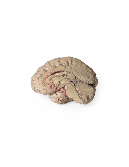 Brain Emission - Erler Zimmer 3D anatomy Series MP1102