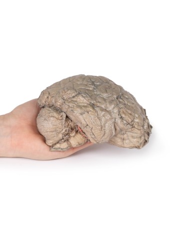 Brain Emission - Erler Zimmer 3D anatomy Series...