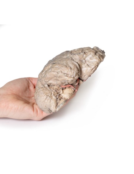 Brain Emission - Erler Zimmer 3D anatomy Series MP1102