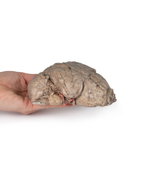 Brain Emission - Erler Zimmer 3D anatomy Series MP1102