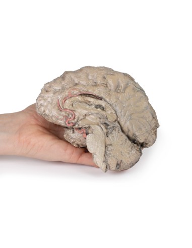 Brain Emission - Erler Zimmer 3D anatomy Series...