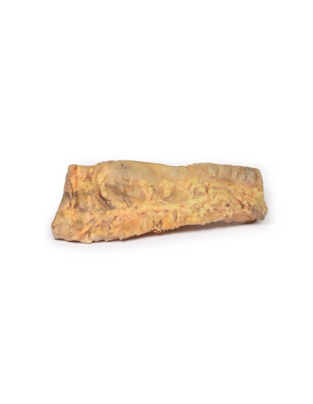 Ulcerative Colitis - Erler Zimmer 3D anatomy Series MP2074