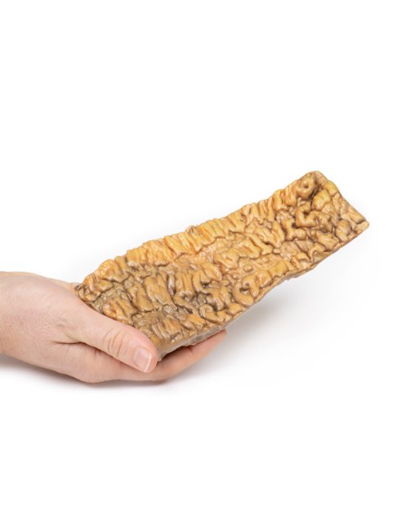 Colitis ulcerosa - Erler Zimmer 3D Anatomie Serie MP2074