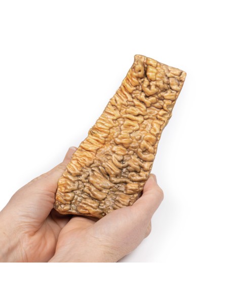Ulcerative Colitis - Erler Zimmer 3D anatomy Series MP2074