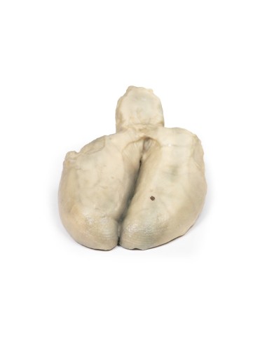 Colecistitis y colelitiasis - Erler Zimmer 3D...