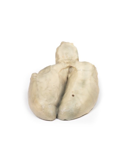 Colecistitis y colelitiasis - Erler Zimmer 3D anatomy Series MP2082