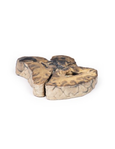 Lesione intracranica - Erler Zimmer 3D anatomy...