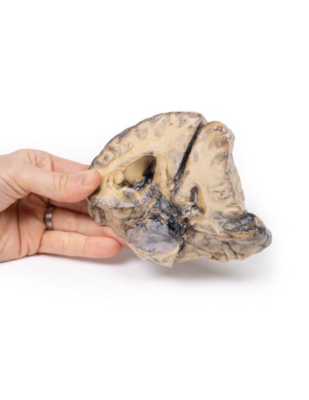 Lesione intracranica - Erler Zimmer 3D anatomy Series MP2011