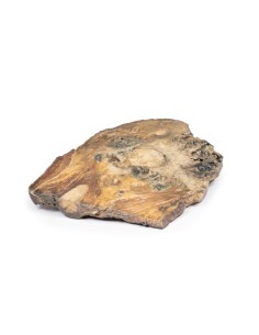 Chondrosarcoma of the femur and ileum - Erler Zimmer 3D... 2