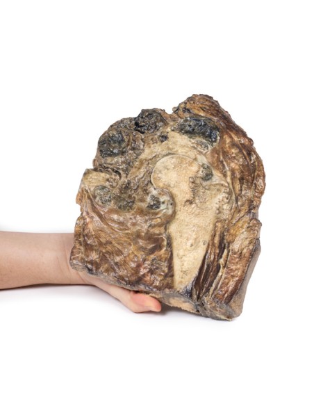 Condrosarcoma del femore e dell'ileo - Erler Zimmer 3D anatomy Series MP2112