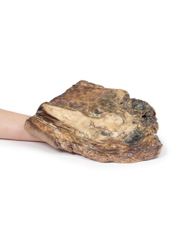 Condrosarcoma del femore e dell'ileo - Erler...