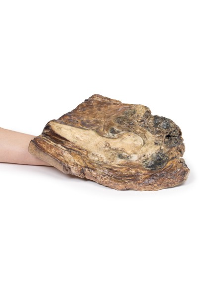 Chondrosarcoma of the femur and ileum - Erler Zimmer 3D anatomy Series MP2112