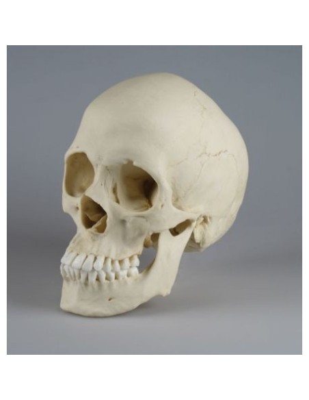 Erler Zimmer, anatomical model of scaphocephalic skull 4778